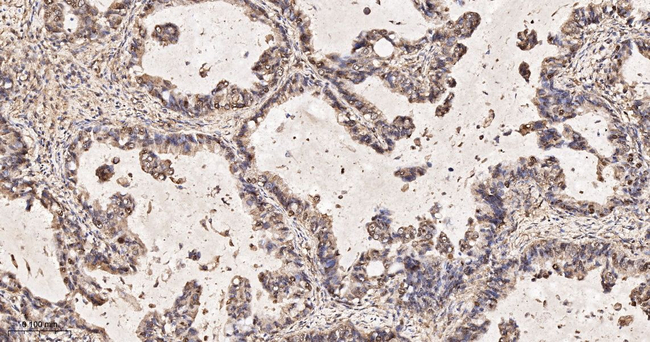 SHC Antibody in Immunohistochemistry (Paraffin) (IHC (P))
