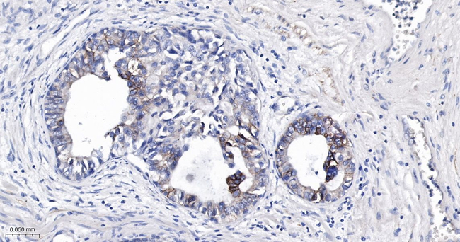 CD166 Antibody in Immunohistochemistry (Paraffin) (IHC (P))