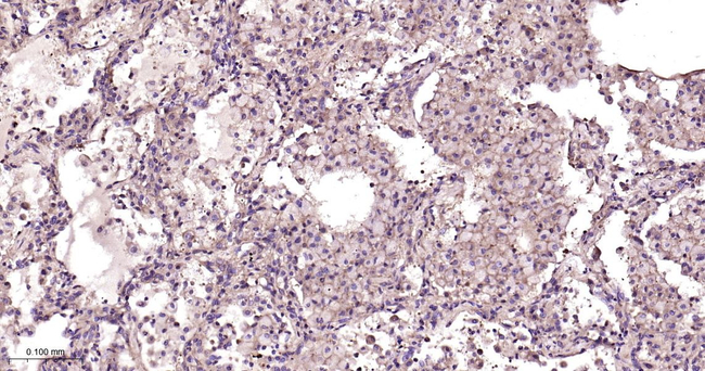TRPM7 Antibody in Immunohistochemistry (Paraffin) (IHC (P))