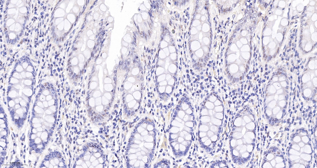 WDR5 Antibody in Immunohistochemistry (Paraffin) (IHC (P))