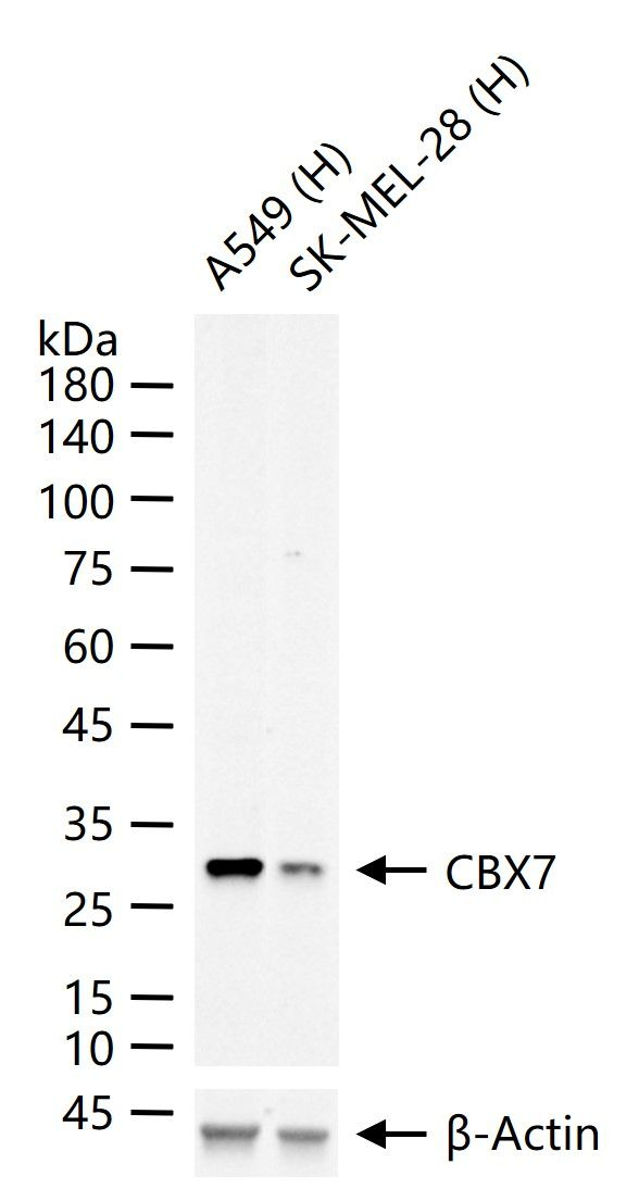 CBX7 Antibody in Western Blot (WB)