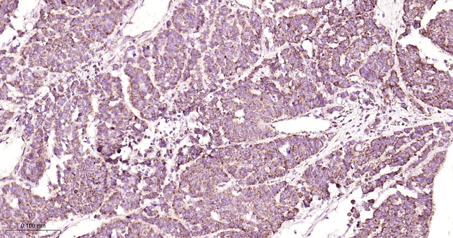 TFAM Antibody in Immunohistochemistry (Paraffin) (IHC (P))
