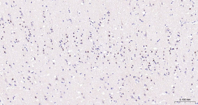 EGR1 Antibody in Immunohistochemistry (Paraffin) (IHC (P))