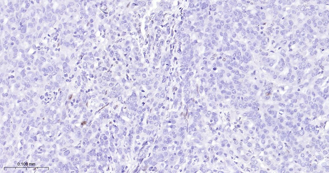 ZEB1 Antibody in Immunohistochemistry (Paraffin) (IHC (P))