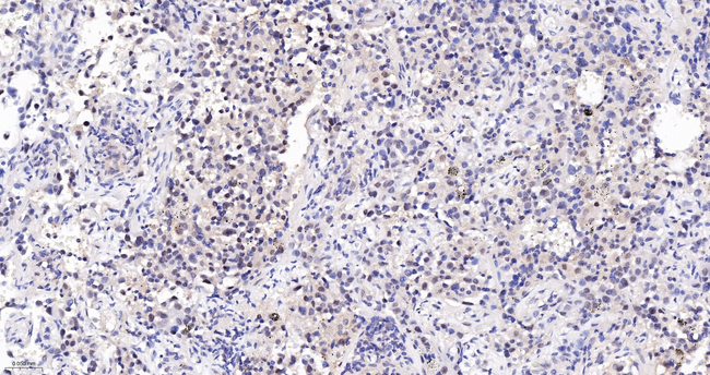 Cullin 1 Antibody in Immunohistochemistry (Paraffin) (IHC (P))