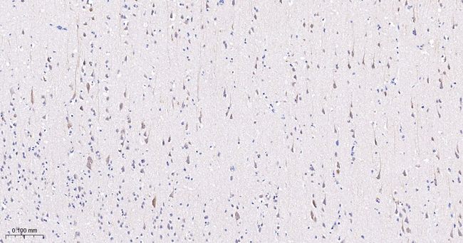 Metadherin Antibody in Immunohistochemistry (Paraffin) (IHC (P))