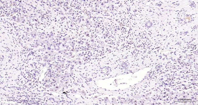 PFKFB3 Antibody in Immunohistochemistry (Paraffin) (IHC (P))