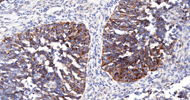 PDK2 Antibody in Immunohistochemistry (Paraffin) (IHC (P))