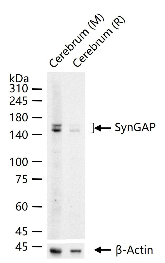 SynGAP Antibody in Western Blot (WB)
