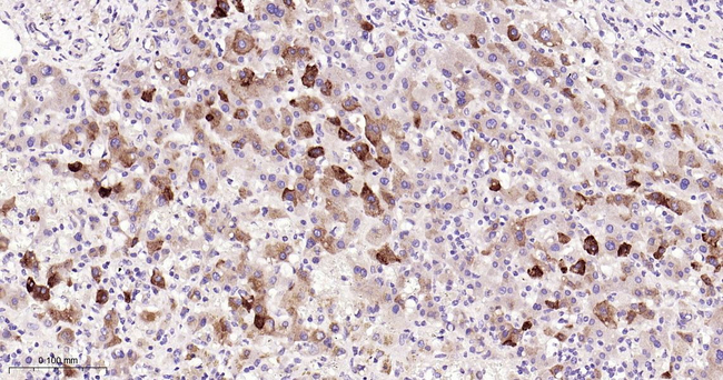 CRP Antibody in Immunohistochemistry (Paraffin) (IHC (P))