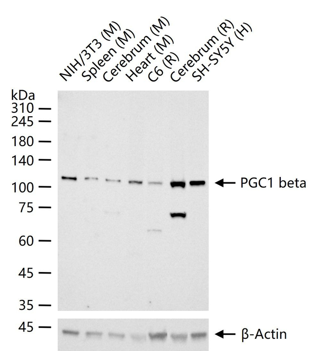 PPARGC1B Antibody in Western Blot (WB)