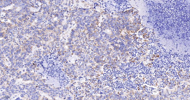 PDHB Antibody in Immunohistochemistry (Paraffin) (IHC (P))