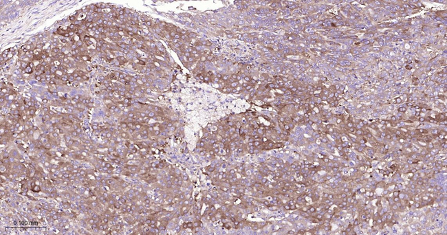 MVP Antibody in Immunohistochemistry (Paraffin) (IHC (P))