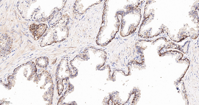 GRK3 Antibody in Immunohistochemistry (Paraffin) (IHC (P))