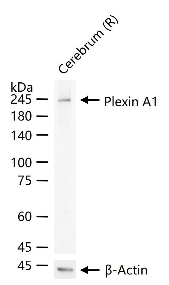 Plexin-A1 Antibody in Western Blot (WB)