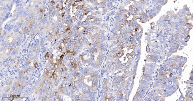 IGFBP2 Antibody in Immunohistochemistry (Paraffin) (IHC (P))