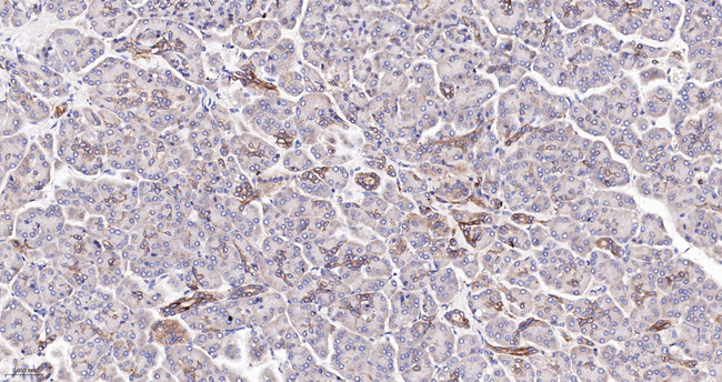 IKK epsilon Antibody in Immunohistochemistry (Paraffin) (IHC (P))