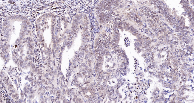 ADAR1 Antibody in Immunohistochemistry (Paraffin) (IHC (P))