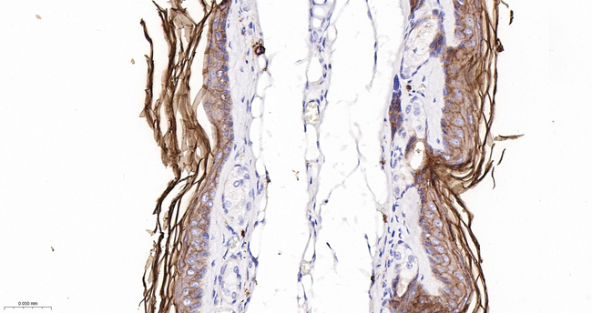 PERP Antibody in Immunohistochemistry (Paraffin) (IHC (P))