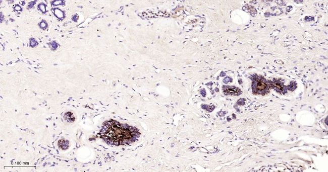 Mammaglobin A Antibody in Immunohistochemistry (Paraffin) (IHC (P))