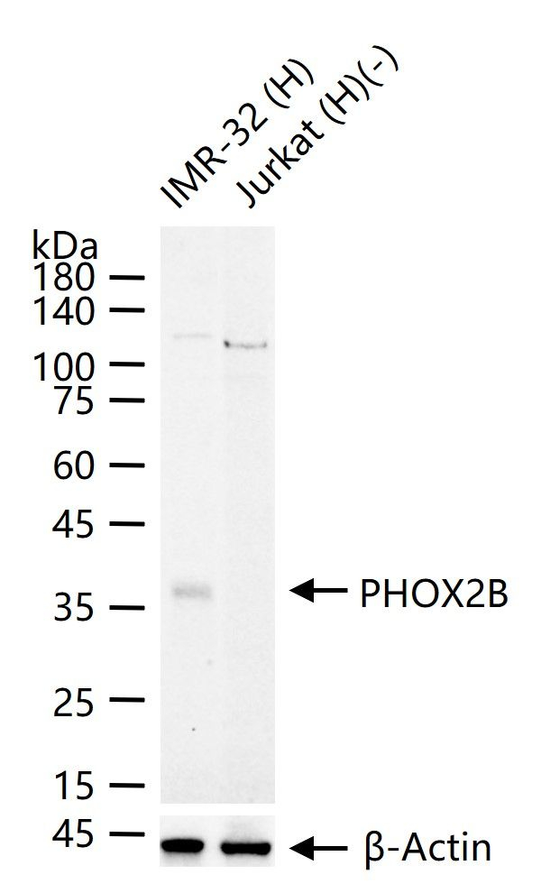 PHOX2B Antibody in Western Blot (WB)