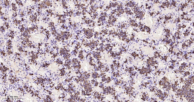 Prolactin Antibody in Immunohistochemistry (Paraffin) (IHC (P))
