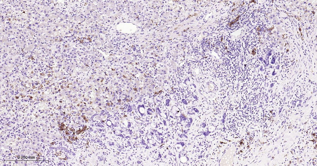 Tartrate Resistant Acid Phosphatase Antibody in Immunohistochemistry (Paraffin) (IHC (P))