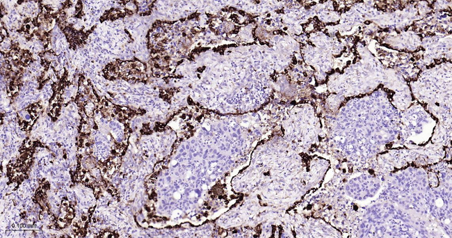 NAPSA Antibody in Immunohistochemistry (Paraffin) (IHC (P))