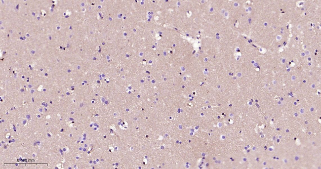 K-cadherin Antibody in Immunohistochemistry (Paraffin) (IHC (P))