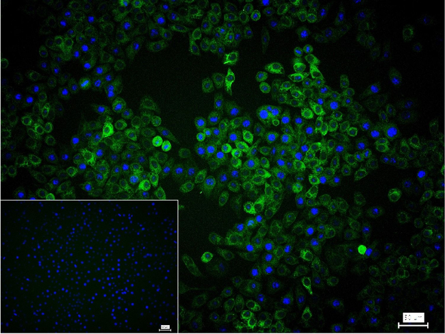RRM1 Antibody in Immunocytochemistry (ICC/IF)