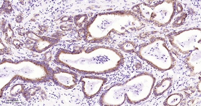IMP3 Antibody in Immunohistochemistry (Paraffin) (IHC (P))
