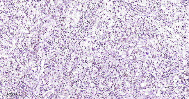 TLE1 Antibody in Immunohistochemistry (Paraffin) (IHC (P))