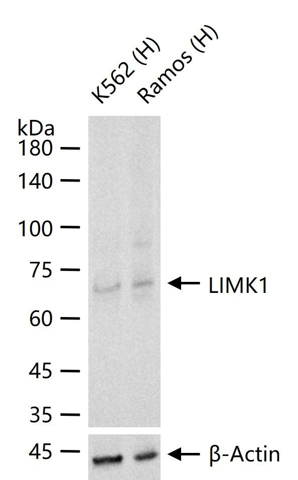 LIMK1 Antibody in Western Blot (WB)