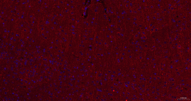 Presenilin 1 Antibody in Immunohistochemistry (Paraffin) (IHC (P))