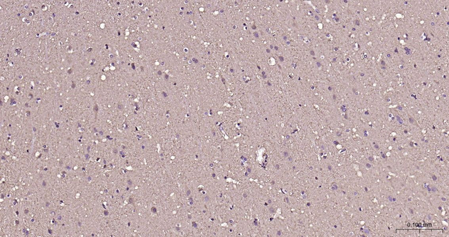 Creatine Kinase BB Antibody in Immunohistochemistry (Paraffin) (IHC (P))