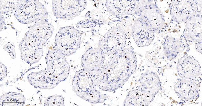SRC1 Antibody in Immunohistochemistry (Paraffin) (IHC (P))