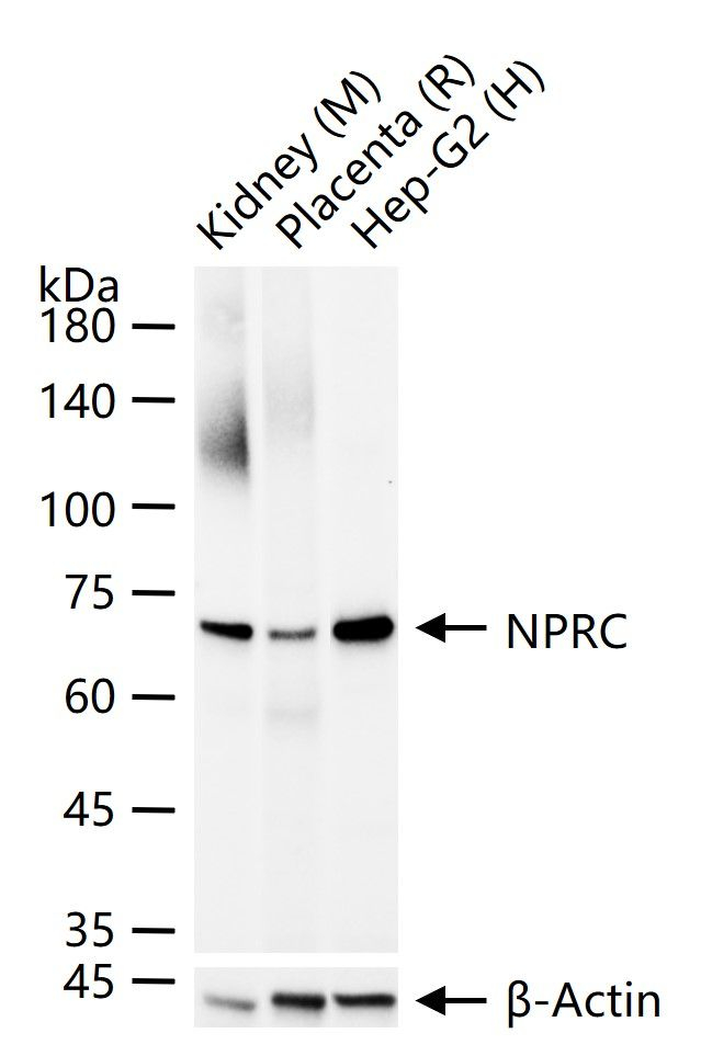 NPR3 Antibody in Western Blot (WB)