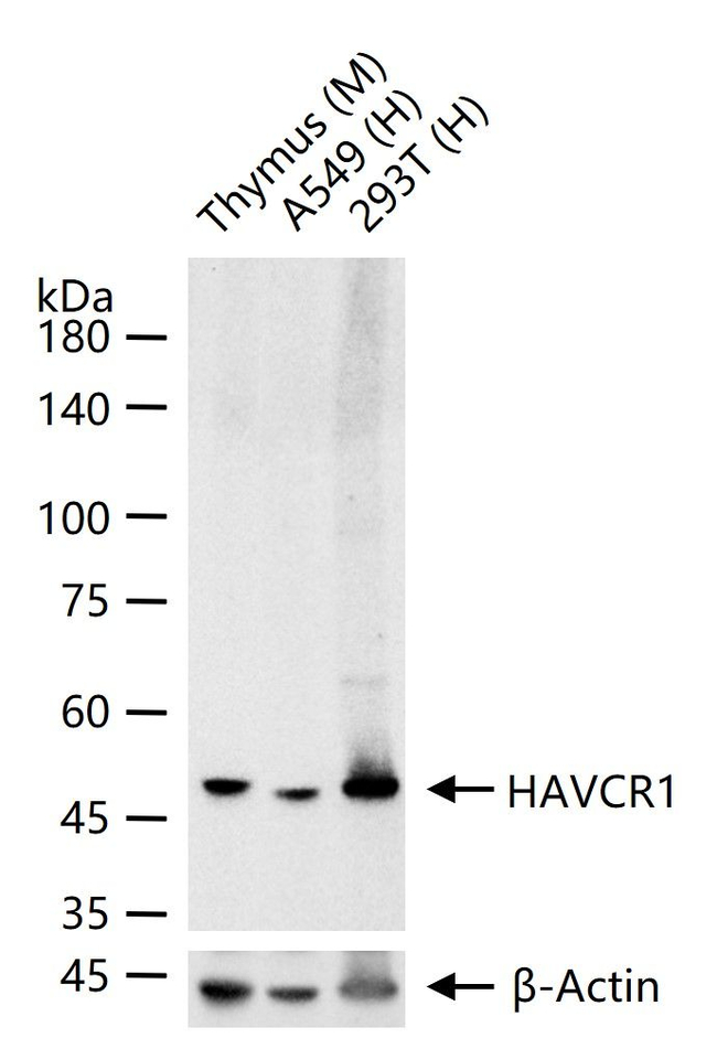 KIM-1 Antibody in Western Blot (WB)