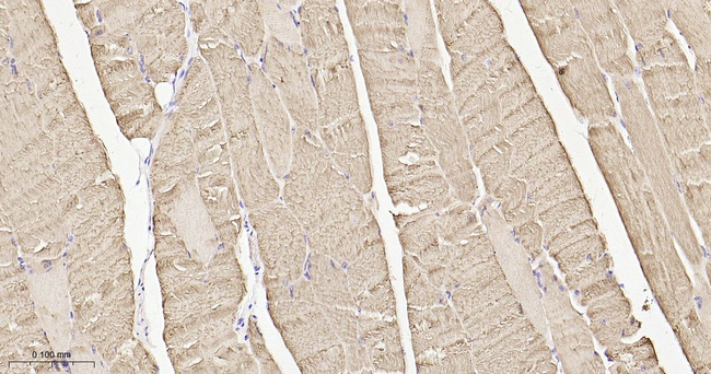 Calsequestrin Antibody in Immunohistochemistry (Paraffin) (IHC (P))