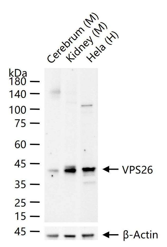 VPS26A Antibody in Western Blot (WB)