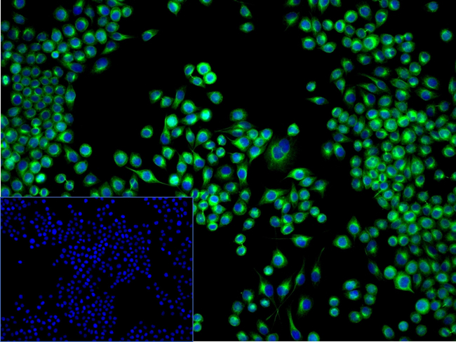 SPRY2 Antibody in Immunocytochemistry (ICC/IF)