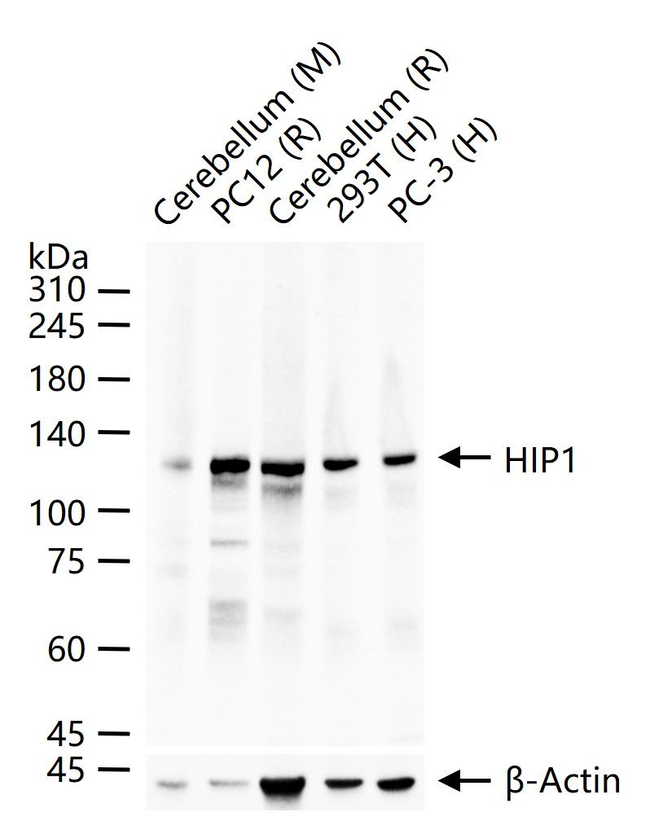 HIP1 Antibody in Western Blot (WB)
