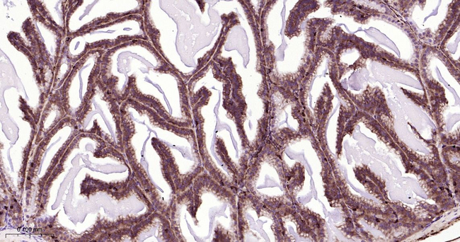 CRMP2 Antibody in Immunohistochemistry (Paraffin) (IHC (P))