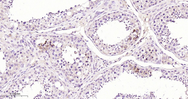 TCL1 Antibody in Immunohistochemistry (Paraffin) (IHC (P))