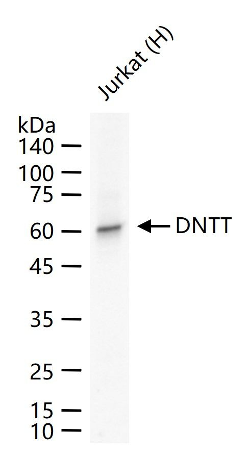 TdT Antibody in Western Blot (WB)