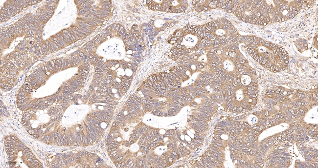 eIF1AX Antibody in Immunohistochemistry (Paraffin) (IHC (P))