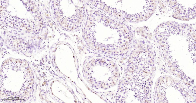 TFE3 Antibody in Immunohistochemistry (Paraffin) (IHC (P))