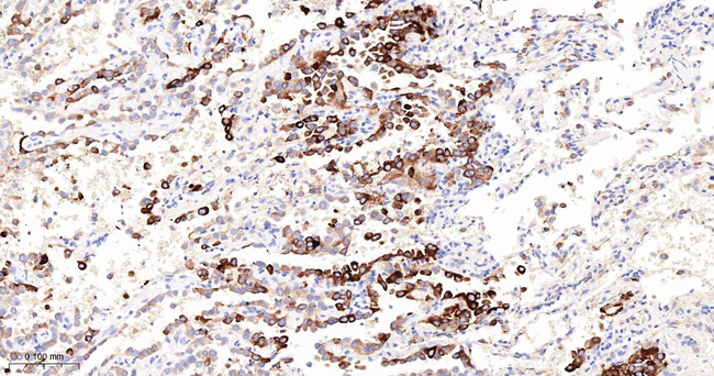 FDFT1 Antibody in Immunohistochemistry (Paraffin) (IHC (P))