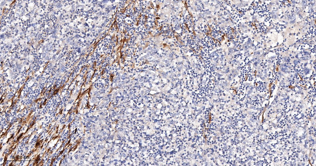 TAGLN Antibody in Immunohistochemistry (Paraffin) (IHC (P))