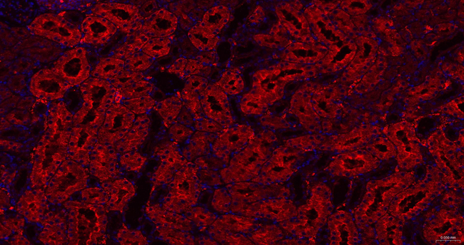 DCP1A Antibody in Immunohistochemistry (Paraffin) (IHC (P))